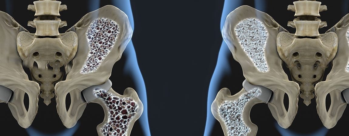 Biology Behind Osteoporosis Revealed in New Study