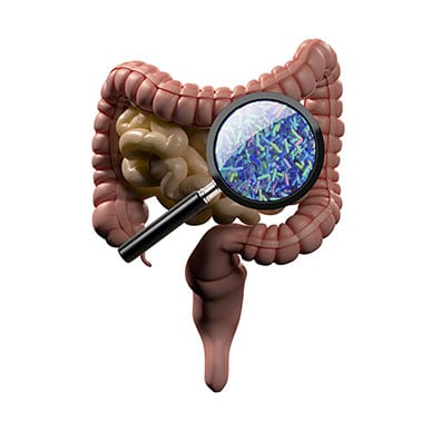 Gut Bacteria and Autoimmune Disease Linked