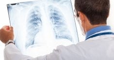 exploring the link between low vitamin d and lung disease 3