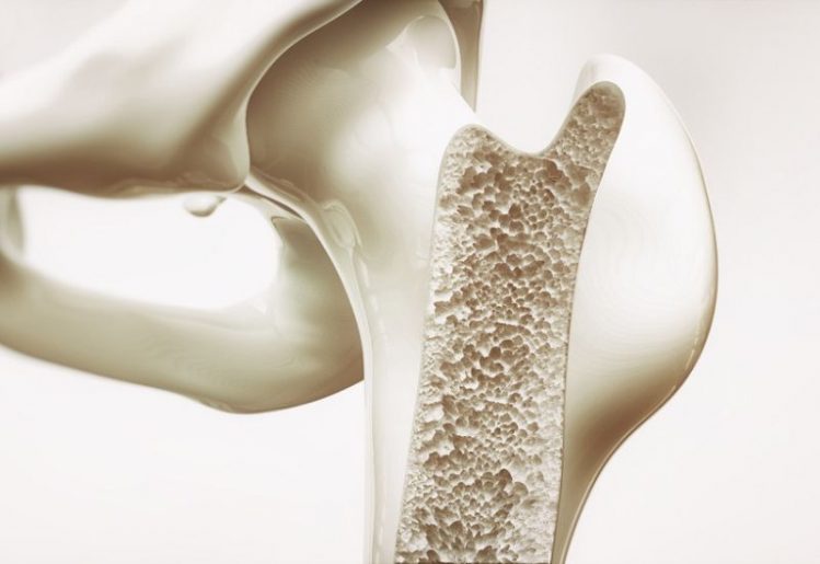 Common Antibacterial Chemical Linked to Osteoporosis 1
