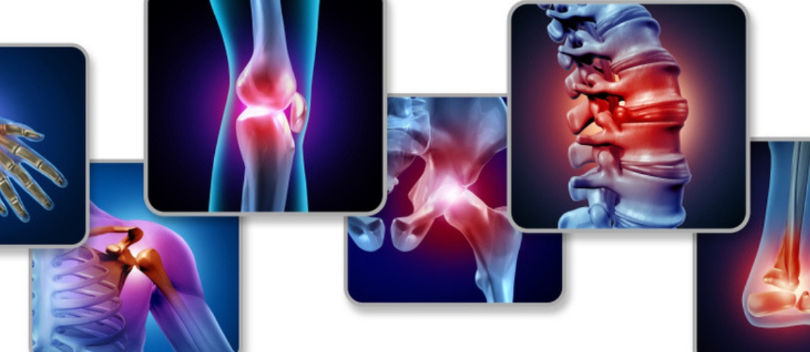 Confirmed Fish Oil May Help Reduce Inflammation