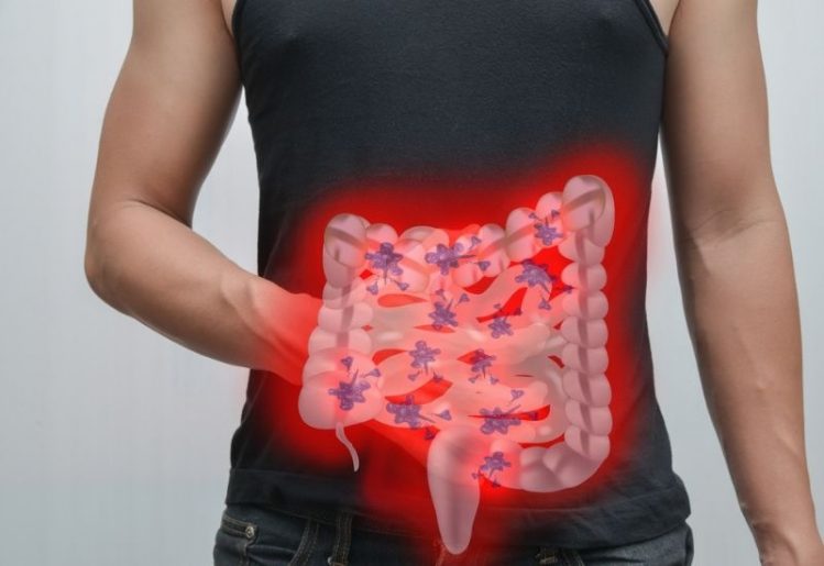 Probiotics May Help Treat Inflammatory Bowel Disease and Other Conditions 1