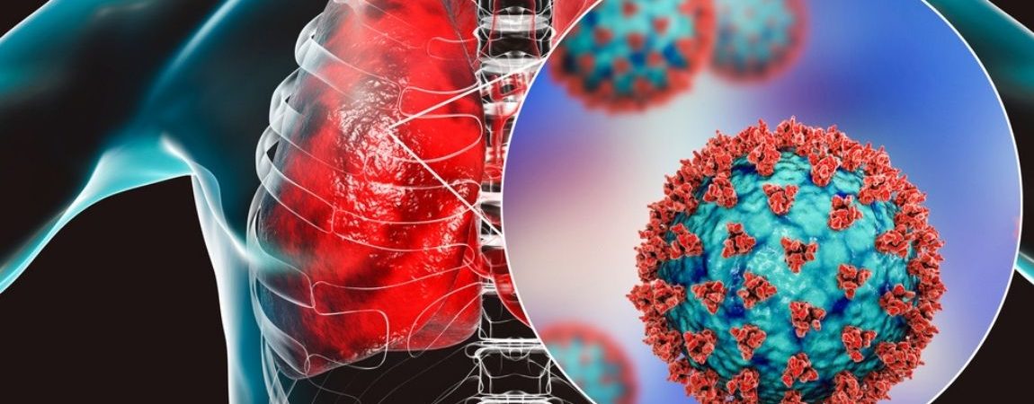 How Vitamin D Could Reduce Lung Inflammation in Covid-19