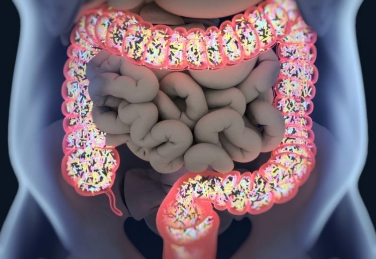 Gut Bacteria Linked to Stroke Severity, Poorer Recovery