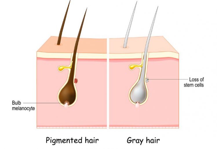 Premature Graying of Hair Can Indicate an Underlying Health Problem